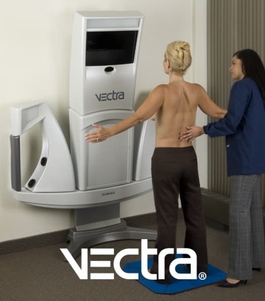 Vectra for Breast Reduction