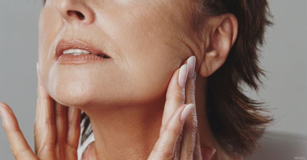 Woman with a smooth neckline after neck lift (model)