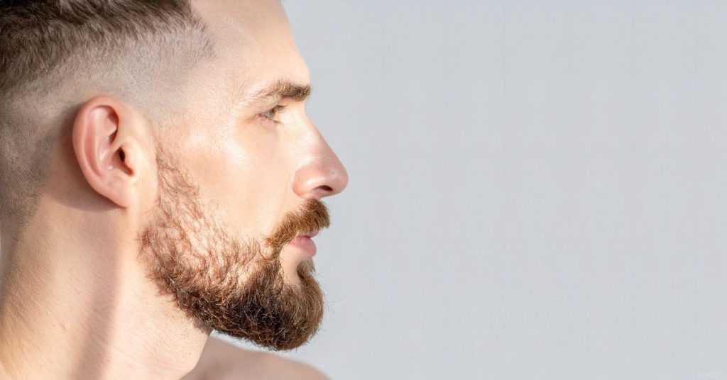 Man with subtle rhinoplasty results (model)