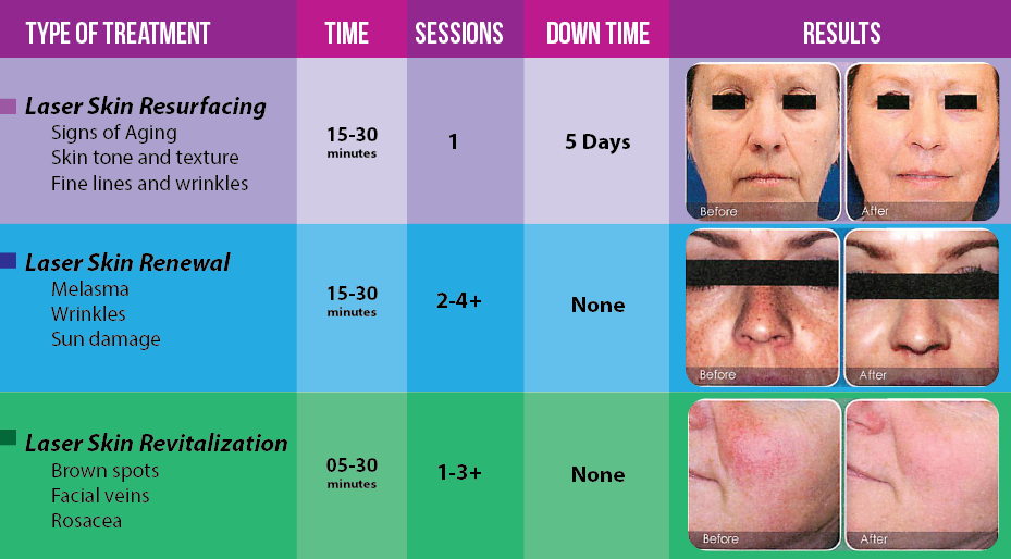 Facial Rejuvenation Chart