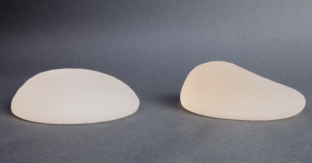 When Breast Implants Go Wrong: Capsular Contracture in Chicago
