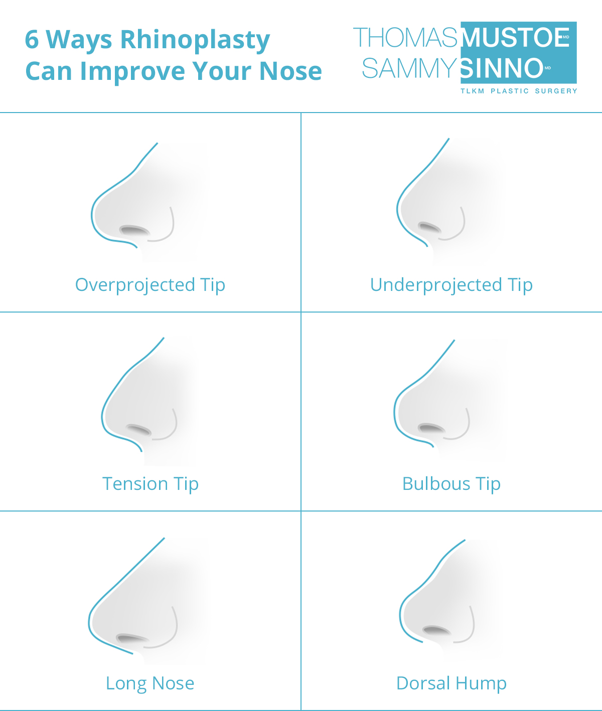 What Rhinoplasty can Fix - Infographic