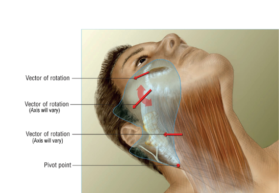 Dr. Mustoe’s signature deep plane facelift approach treats the skin, fat, and superficial muscle layer as an integrated unit. He completely releases retaining ligaments for natural, long-lasting rejuvenation. 