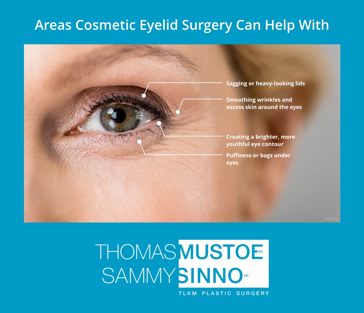Areas cosmetic eyelid surgery can help with.
