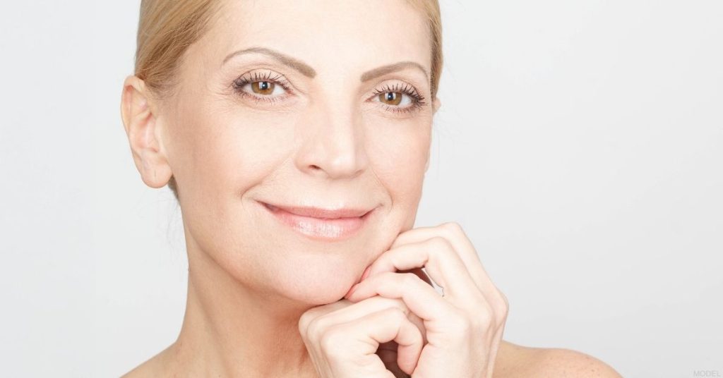 Woman after eyelid surgery. (Model)