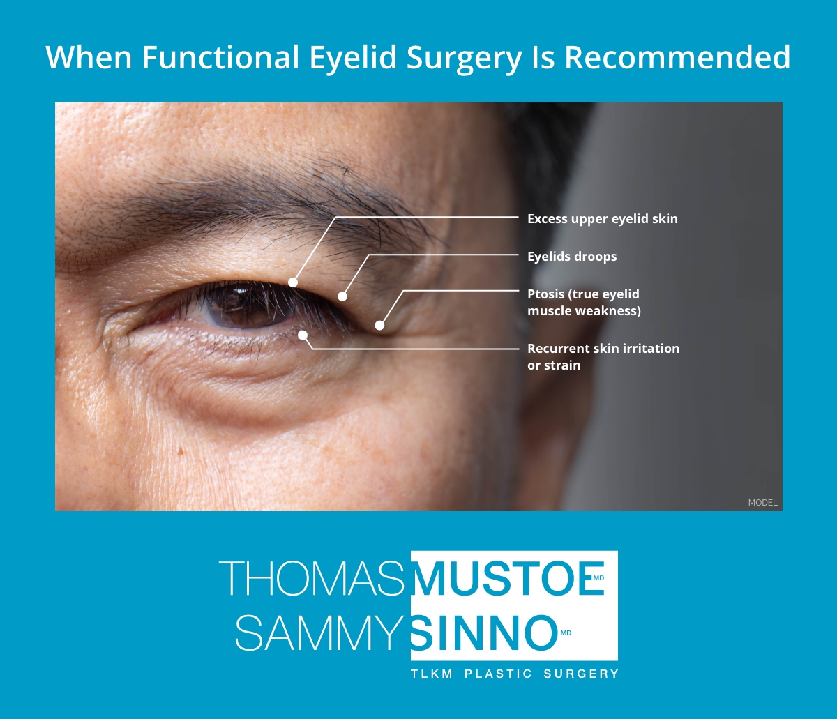 When functional eyelid surgery is recommended.