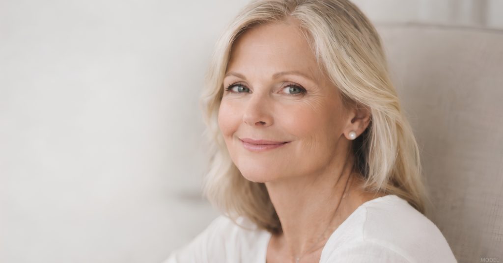 Woman after a deep plane facelift procedure. (Model)